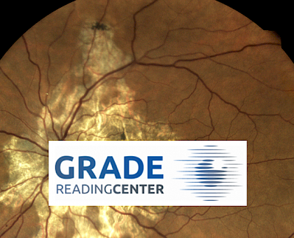 Netzhaut Bild Serpiginosa und GRADE Reading Center Logo